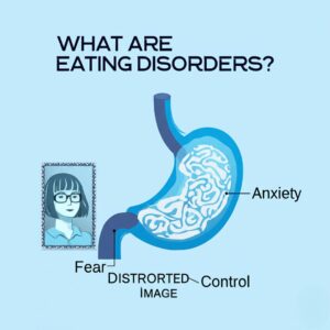 Eating Disorder Help : Your Comprehensive Guide to Understanding and Support